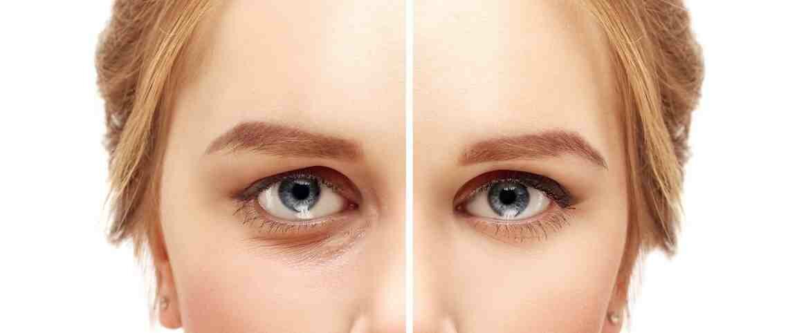 Quels sont les 3 types de vieillissement ?