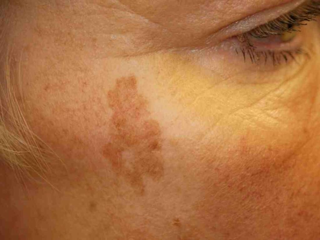 Qu'est-ce qui vieillit le visage ?
