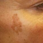 Qu'est-ce qui vieillit le visage ?