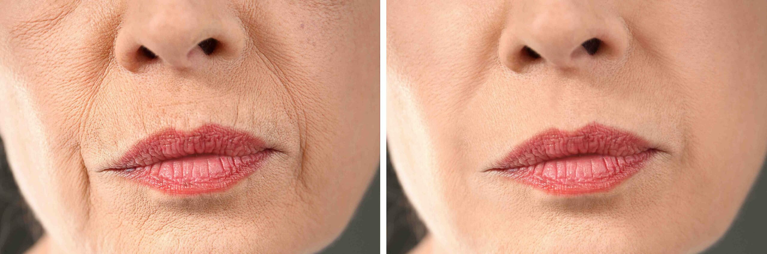 Quel est le meilleur Anti-rides naturel pour le visage ?