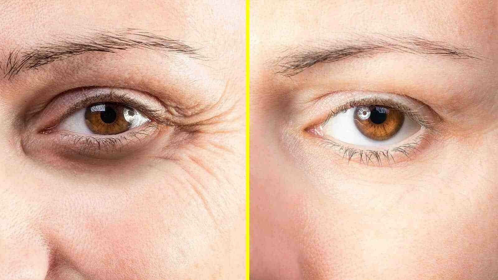 Quelle huile essentielle pour le relâchement de la peau ?